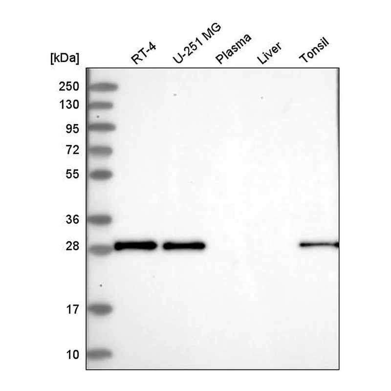 Atlas Antibodies Anti-MOSPD3 Antibody