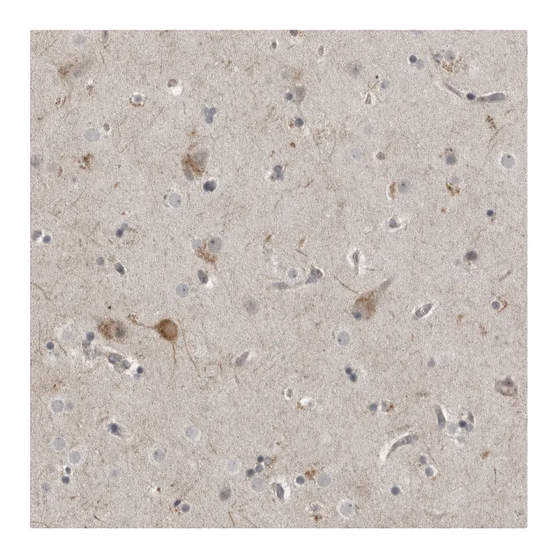 Atlas Antibodies Anti-MPDZ Antibody