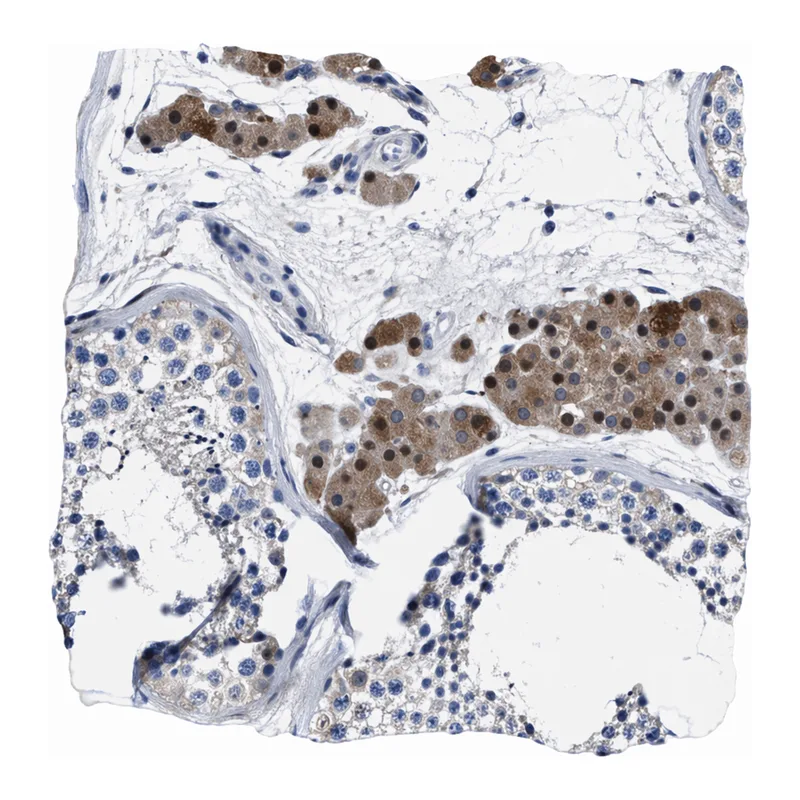 Atlas Antibodies Anti-MOV10L1 Antibody