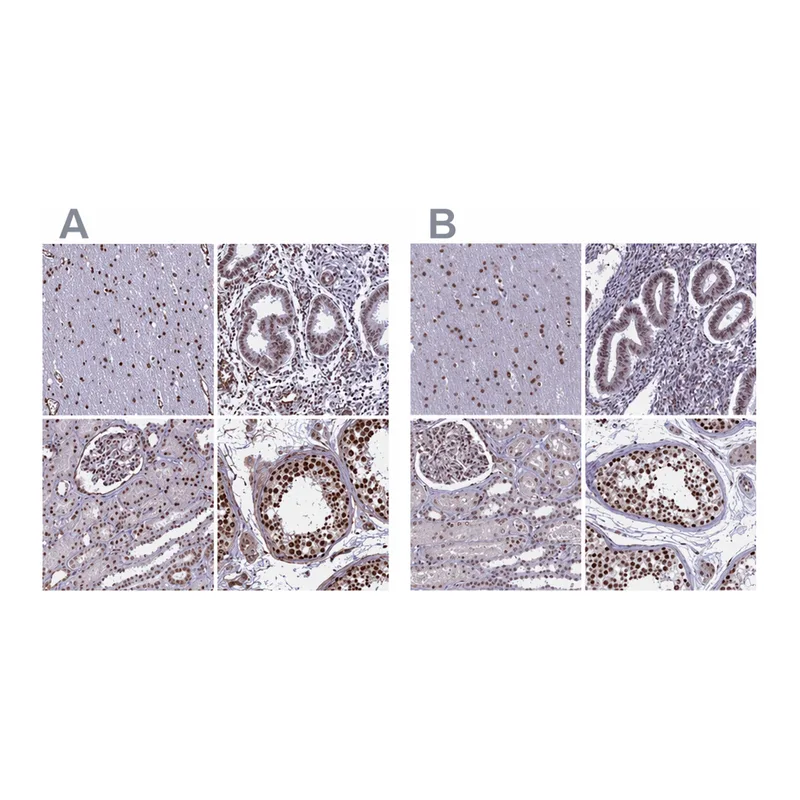 Atlas Antibodies Anti-MPHOSPH8 Antibody
