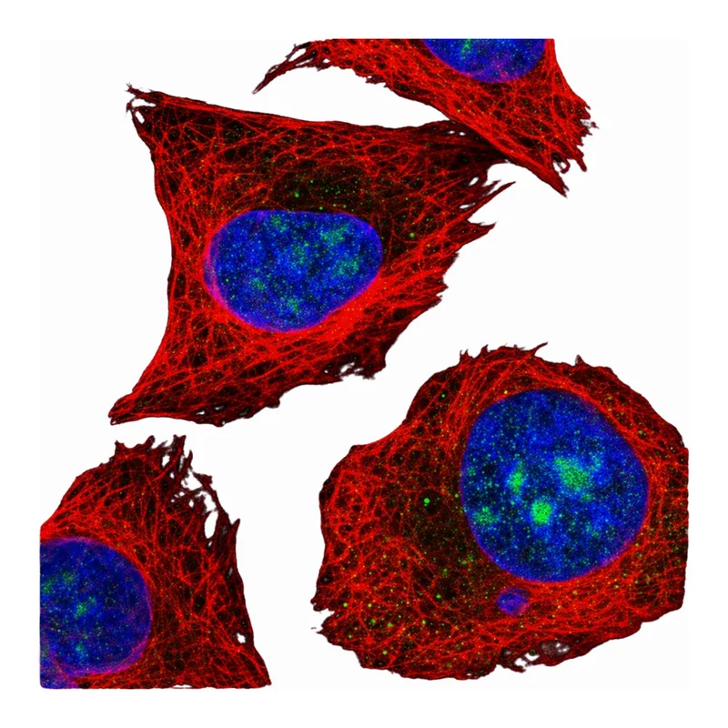 Atlas Antibodies Anti-MPHOSPH10 Antibody