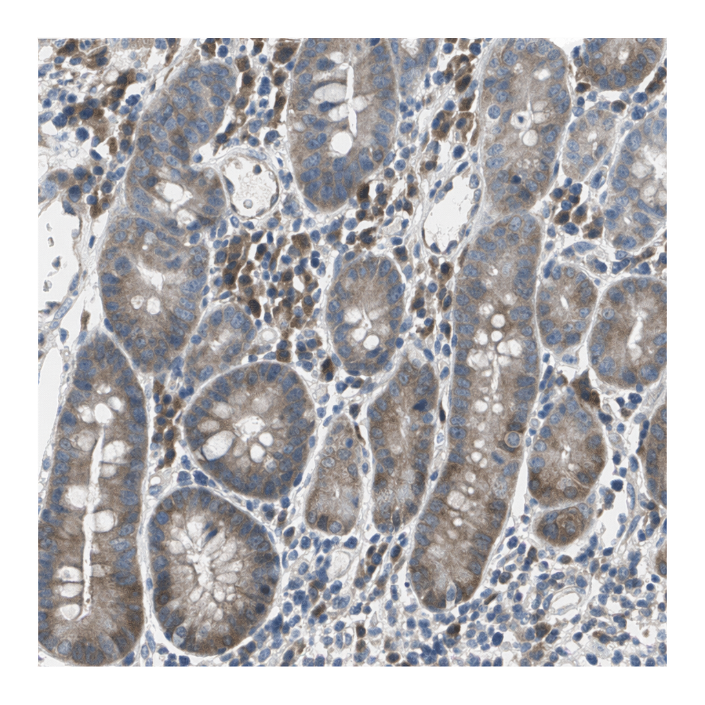 Atlas Antibodies Anti-MPI Antibody