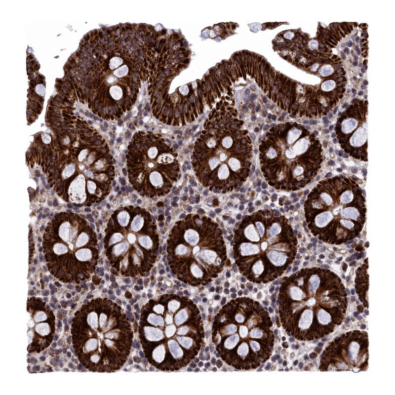 Atlas Antibodies Anti-MPND Antibody