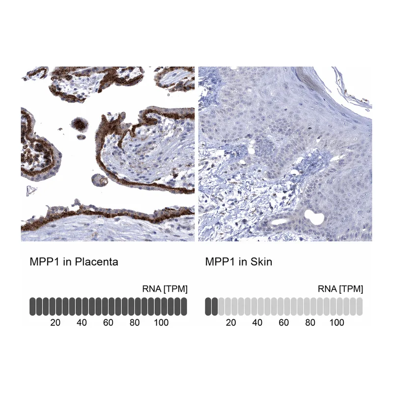 Atlas Antibodies Anti-MPP1 Antibody
