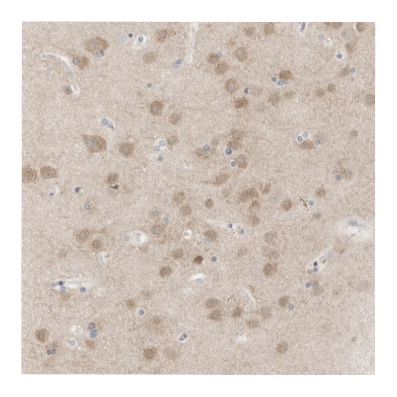 Atlas Antibodies Anti-MPP2 Antibody