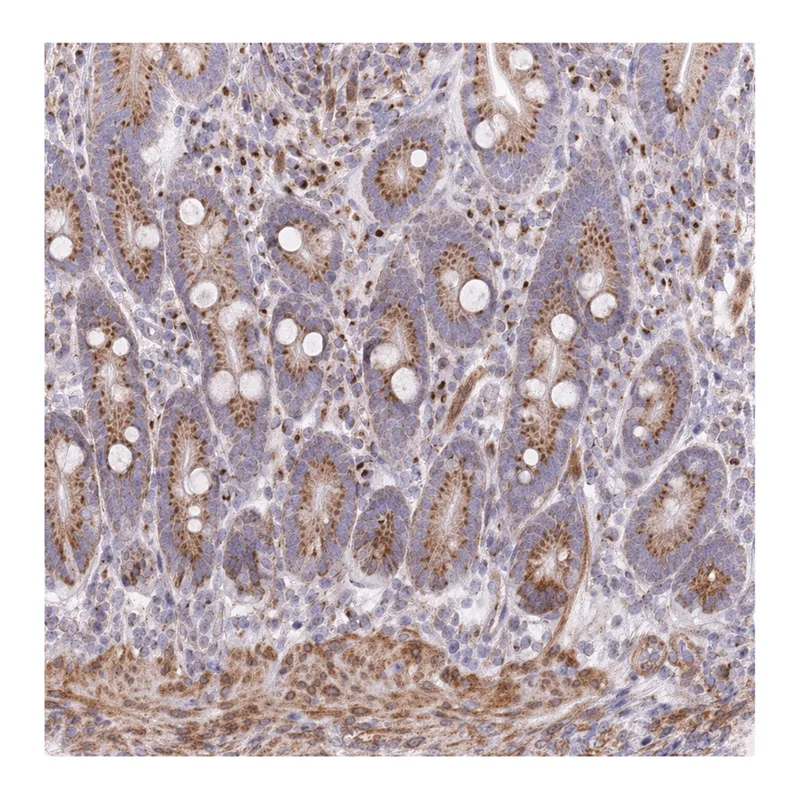 Atlas Antibodies Anti-MPND Antibody