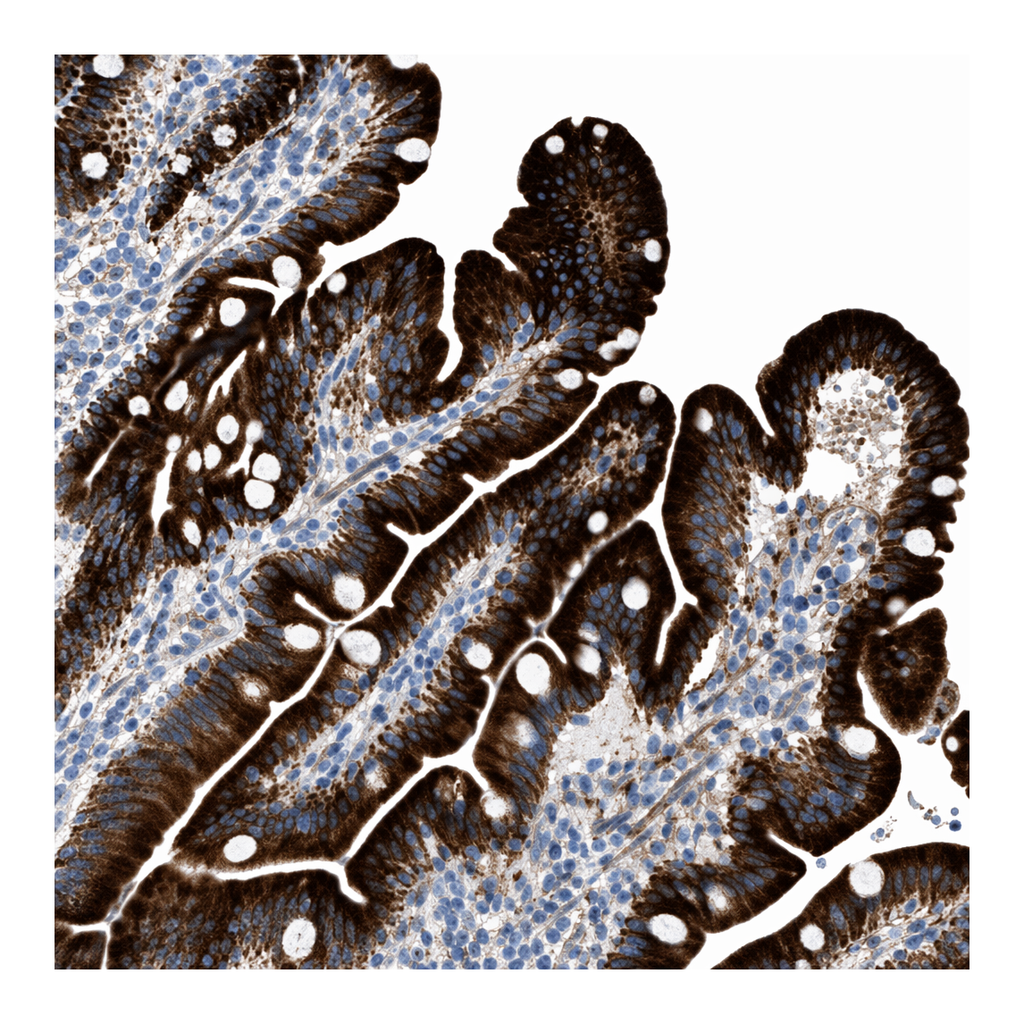 Atlas Antibodies Anti-MPP3 Antibody