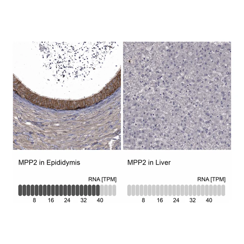 Atlas Antibodies Anti-MPP2 Antibody