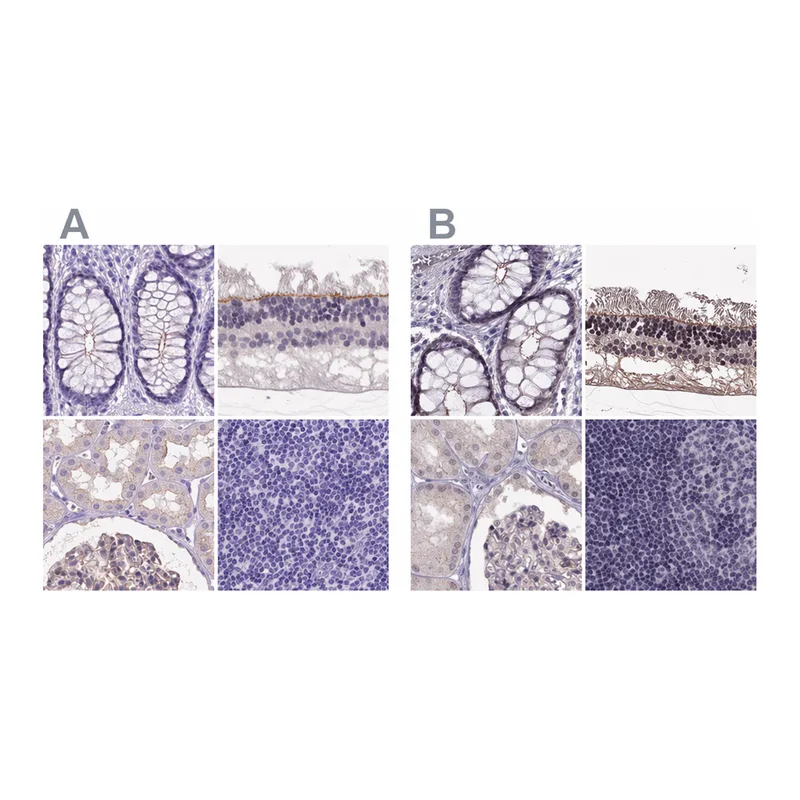 Atlas Antibodies Anti-MPP5 Antibody
