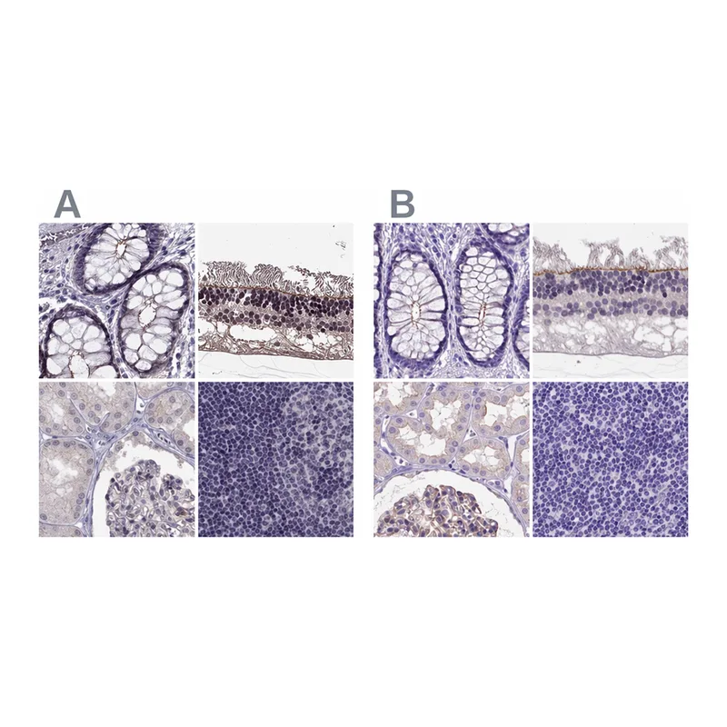 Atlas Antibodies Anti-MPP5 Antibody