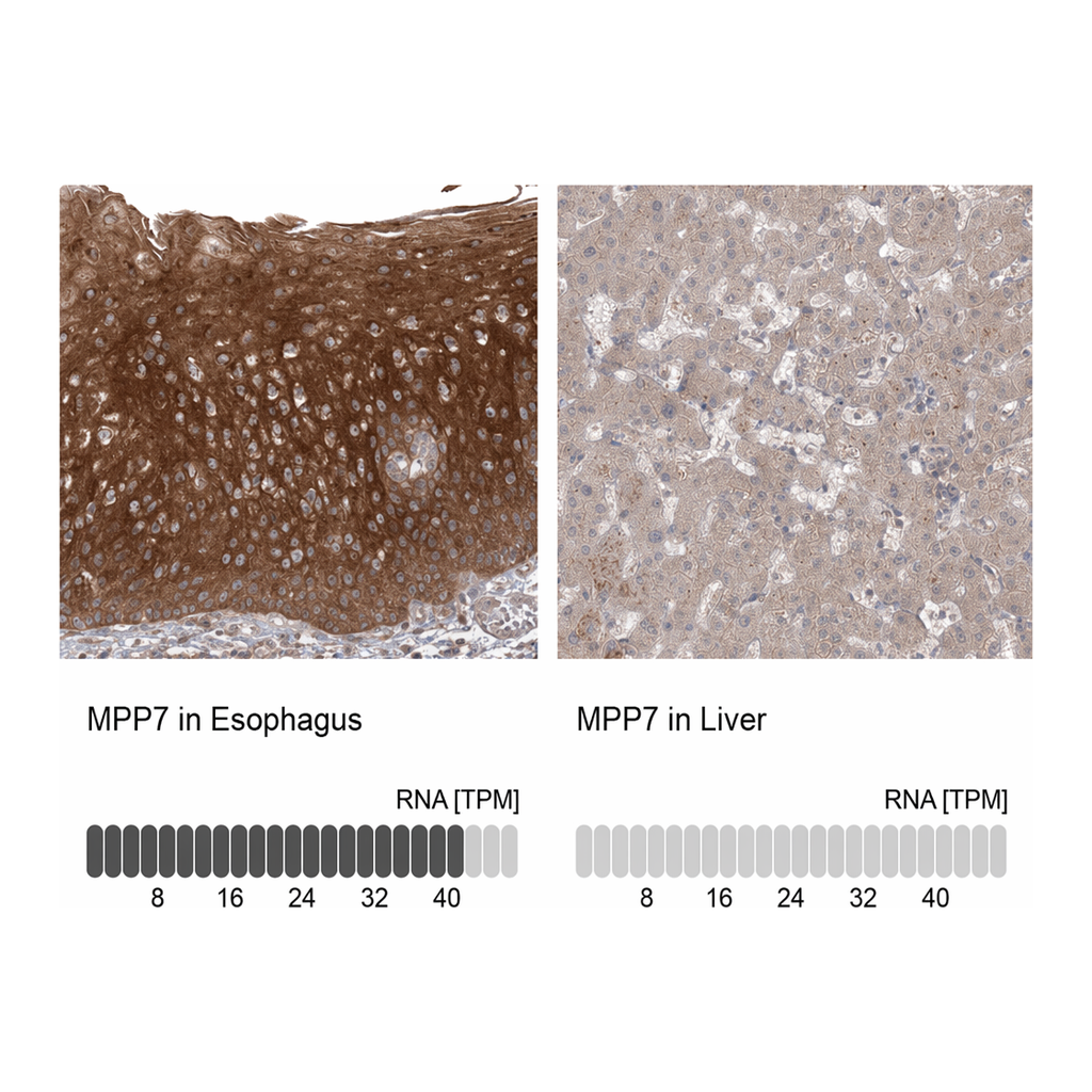 Atlas Antibodies Anti-MPP7 Antibody