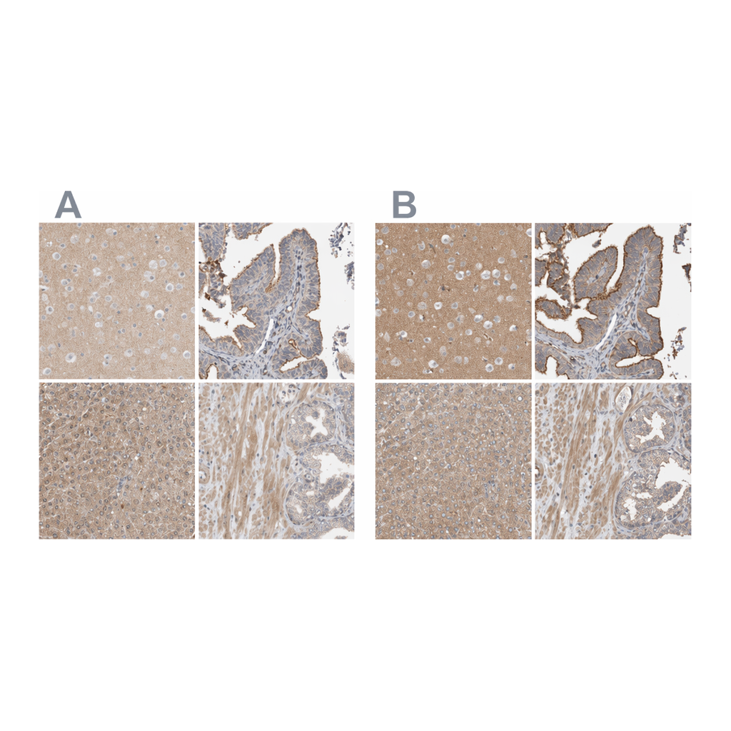 Atlas Antibodies Anti-MPRIP Antibody