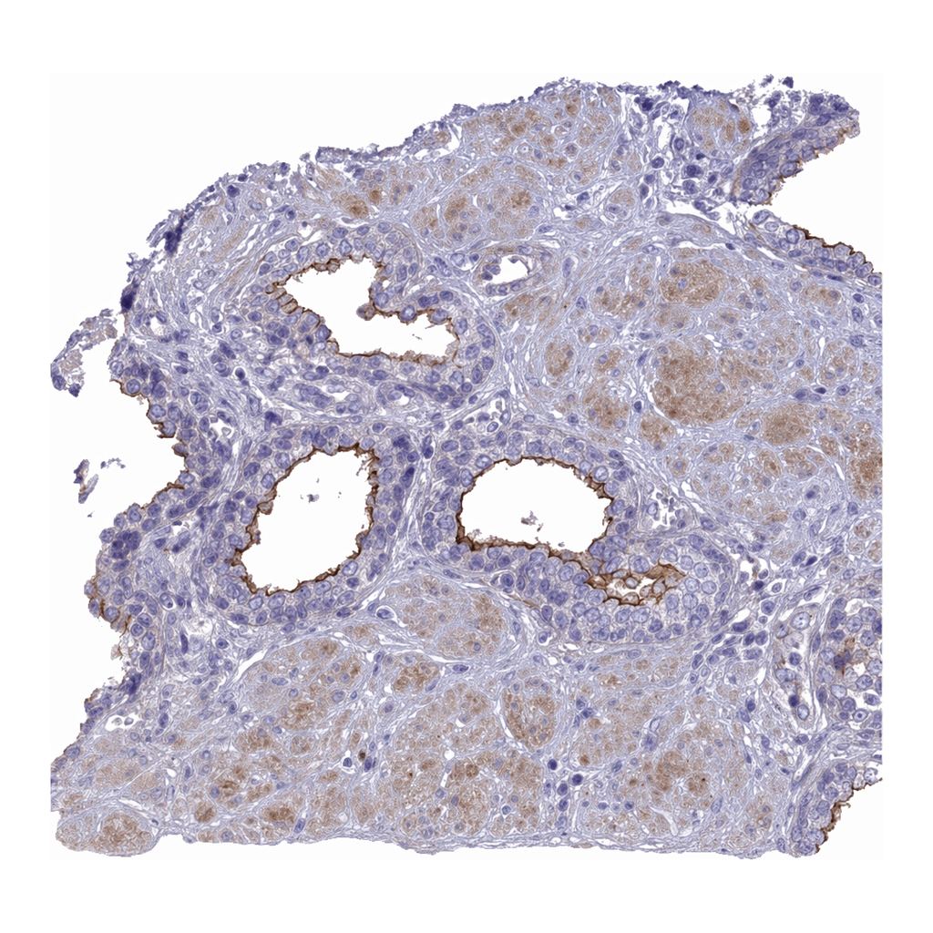 Atlas Antibodies Anti-MPV17L2 Antibody