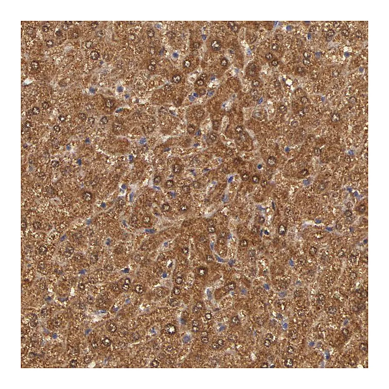 Atlas Antibodies Anti-MPST Antibody