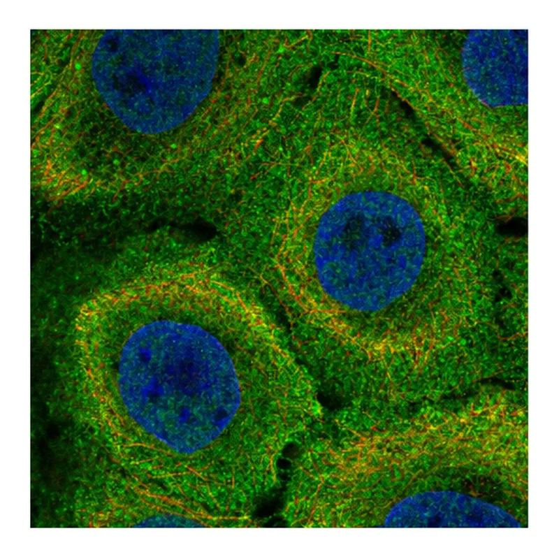 Atlas Antibodies Anti-MR1 Antibody