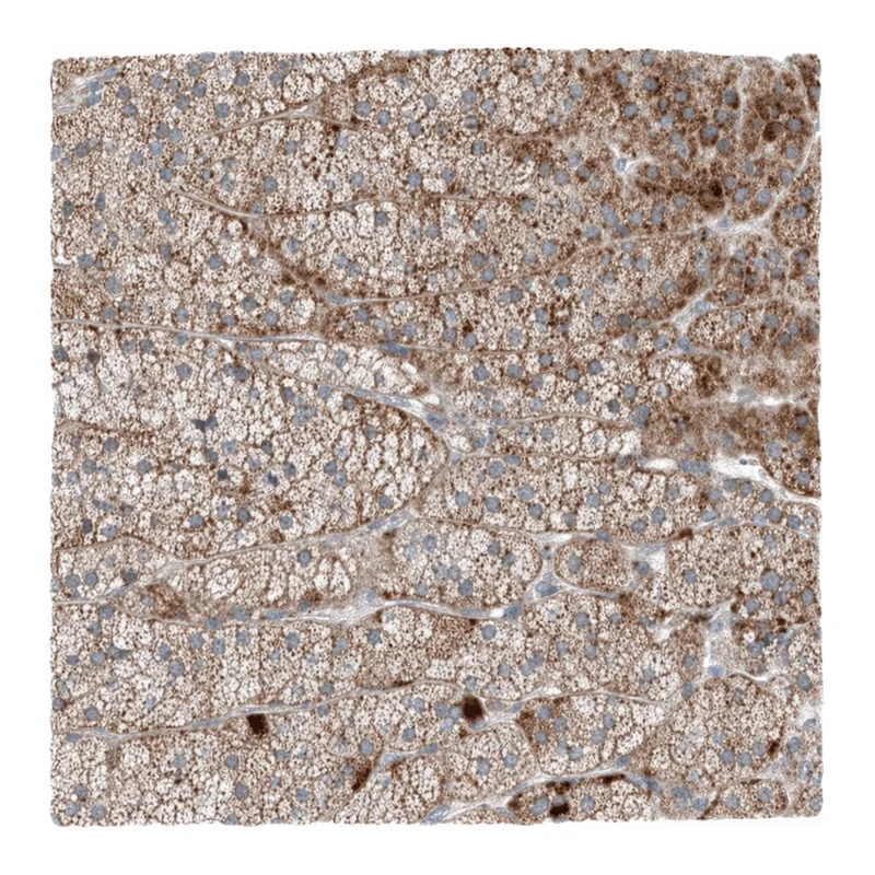 Atlas Antibodies Anti-MRAP Antibody