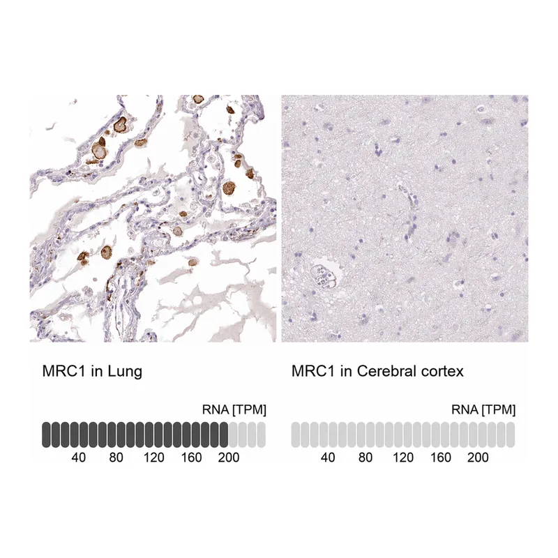 Atlas Antibodies Anti-MRC1 Antibody