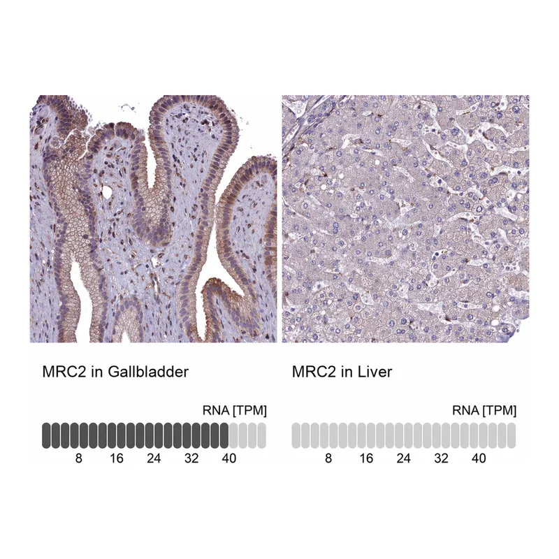 Atlas Antibodies Anti-MRC2 Antibody
