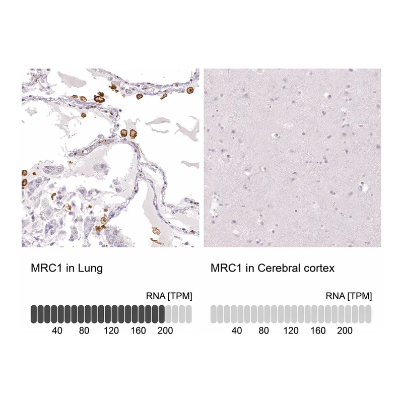 Atlas Antibodies Anti-MRC1 Antibody