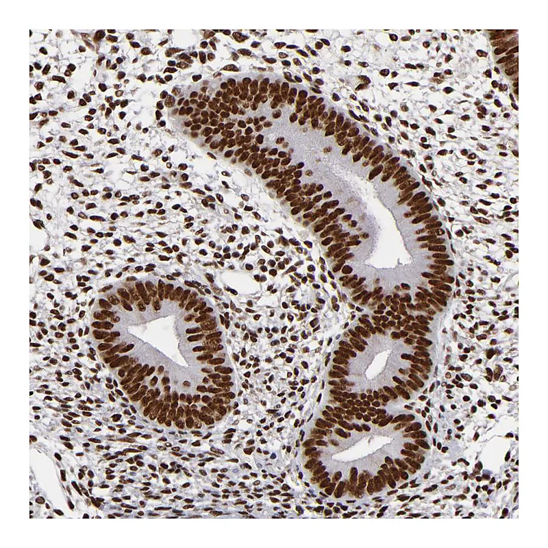 Atlas Antibodies Anti-MRE11 Antibody