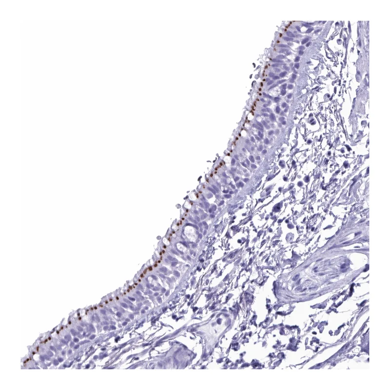 Atlas Antibodies Anti-MRGPRG Antibody