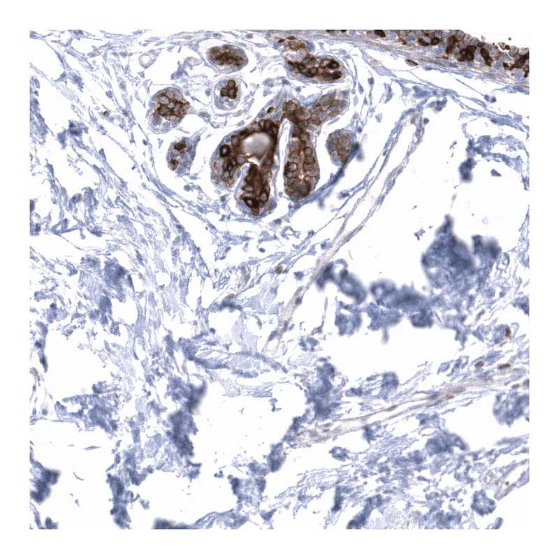 Atlas Antibodies Anti-MRGPRX2 Antibody