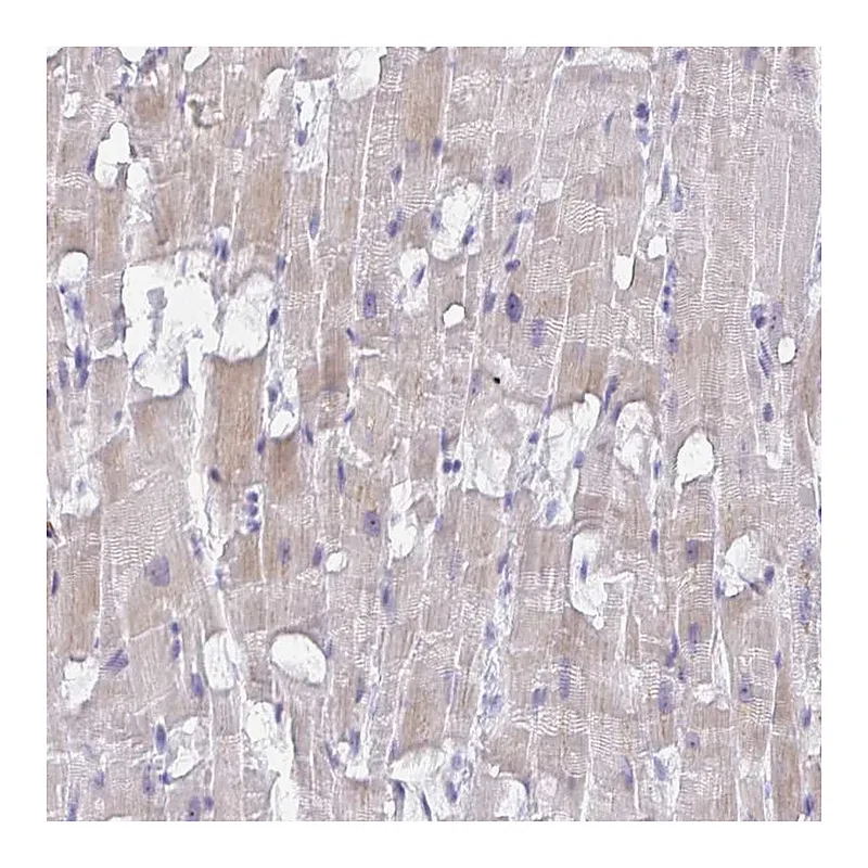 Atlas Antibodies Anti-MRM2 Antibody