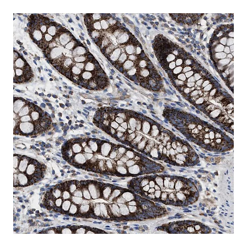 Atlas Antibodies Anti-MRM1 Antibody