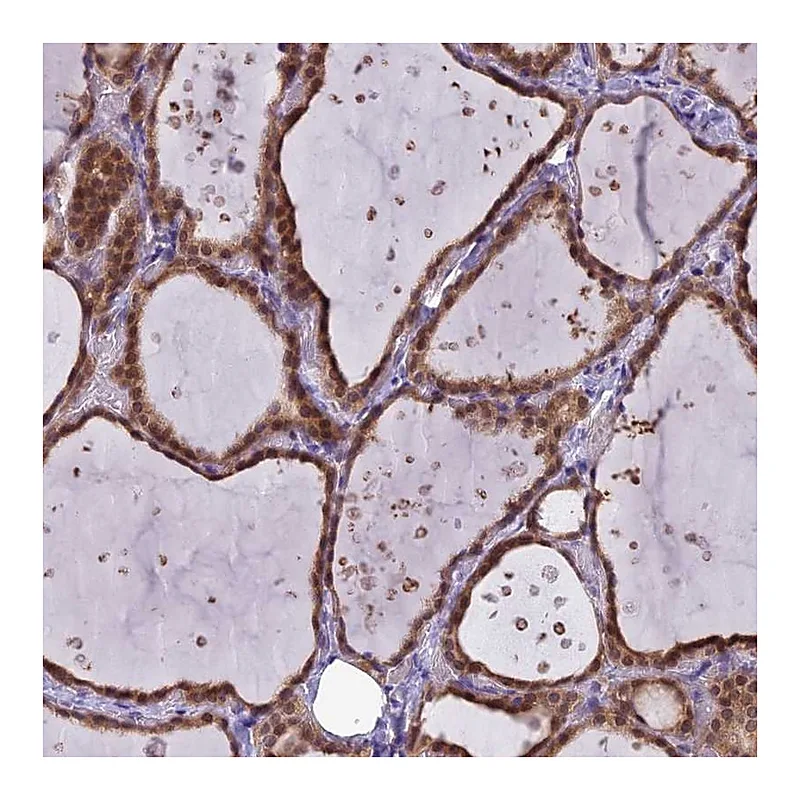 Atlas Antibodies Anti-MRI1 Antibody