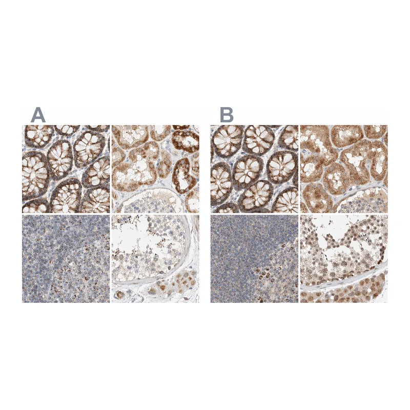 Atlas Antibodies Anti-MRM3 Antibody