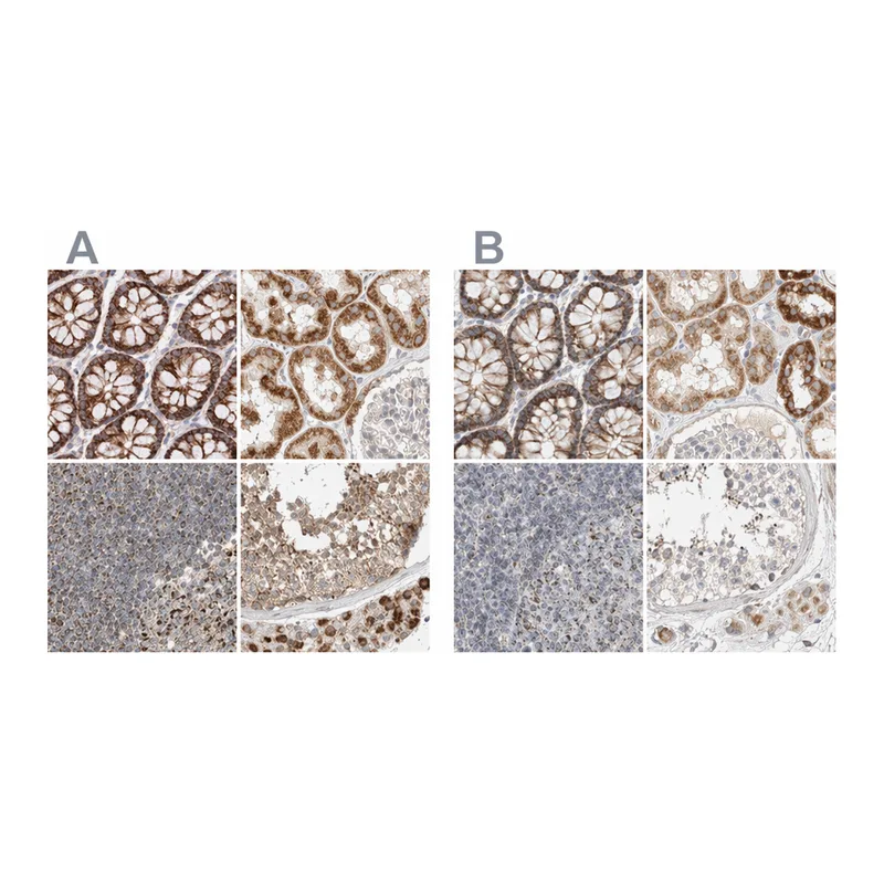 Atlas Antibodies Anti-MRM3 Antibody