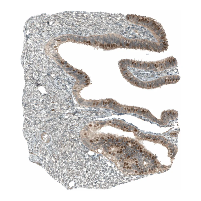 Atlas Antibodies Anti-MRNIP Antibody
