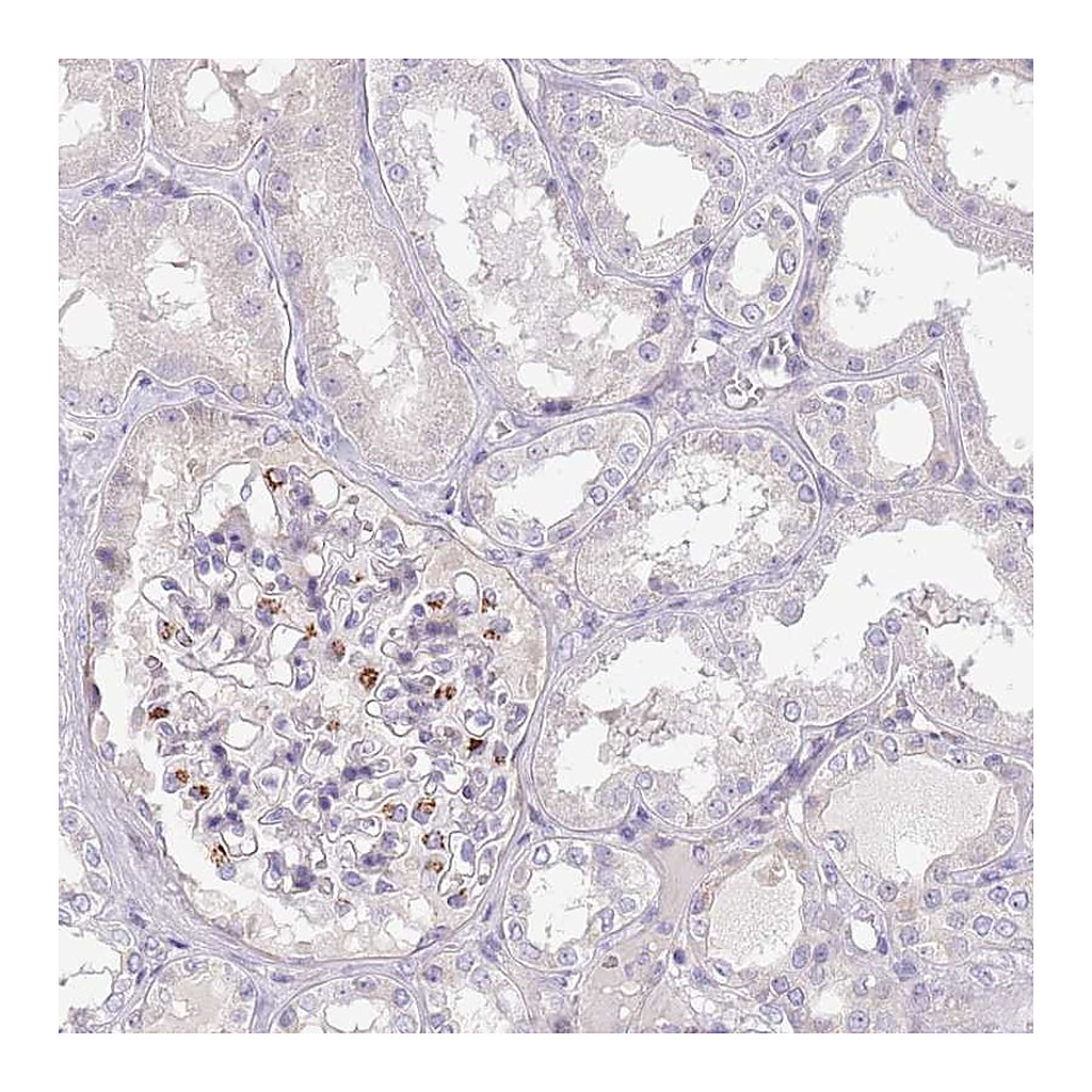 Atlas Antibodies Anti-MRO Antibody