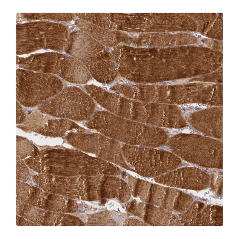 Atlas Antibodies Anti-MROH6 Antibody