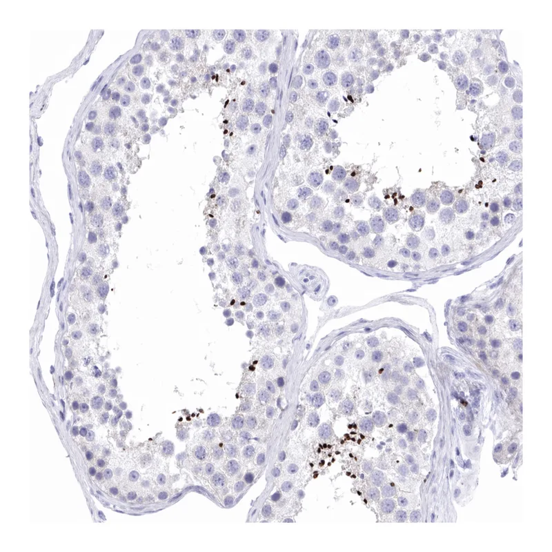 Atlas Antibodies Anti-MROH2B Antibody