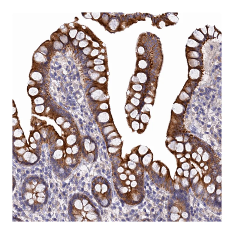 Atlas Antibodies Anti-MROH1 Antibody