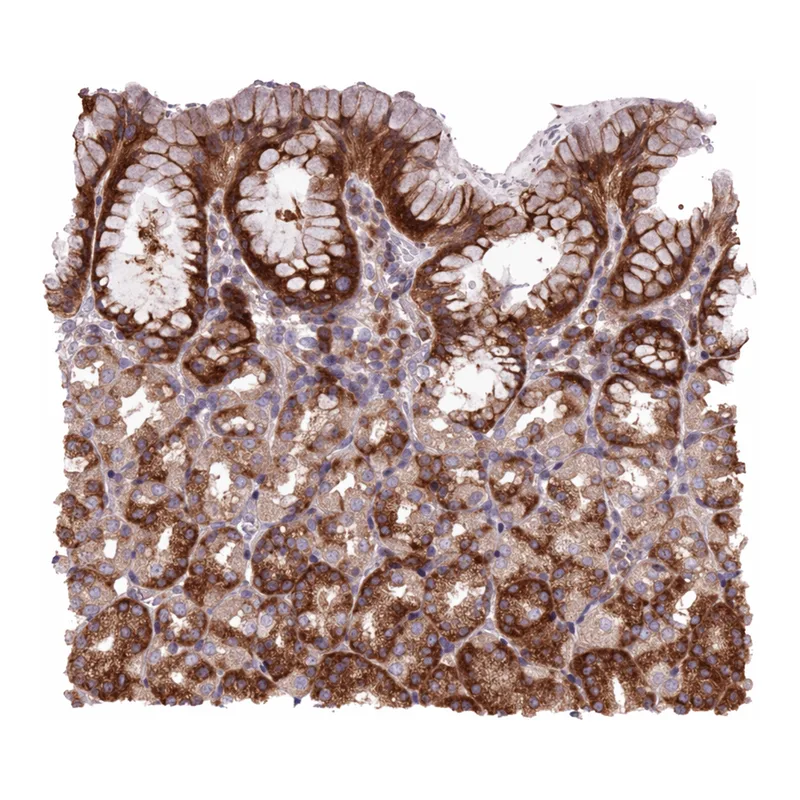 Atlas Antibodies Anti-MROH2A Antibody