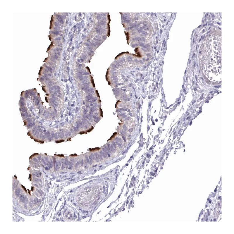 Atlas Antibodies Anti-MROH8 Antibody