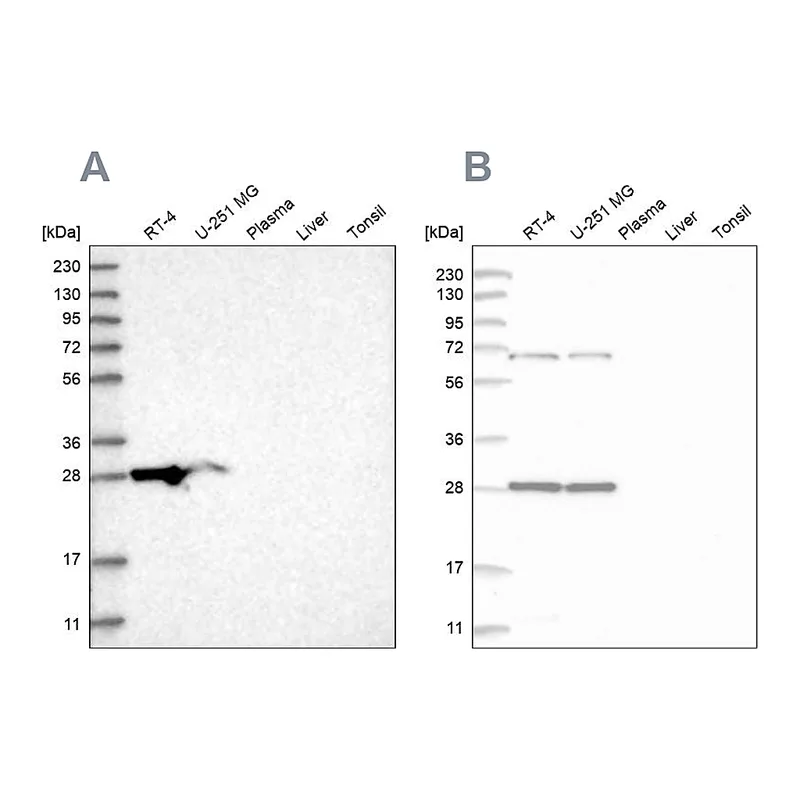 Atlas Antibodies Anti-MRPL10 Antibody