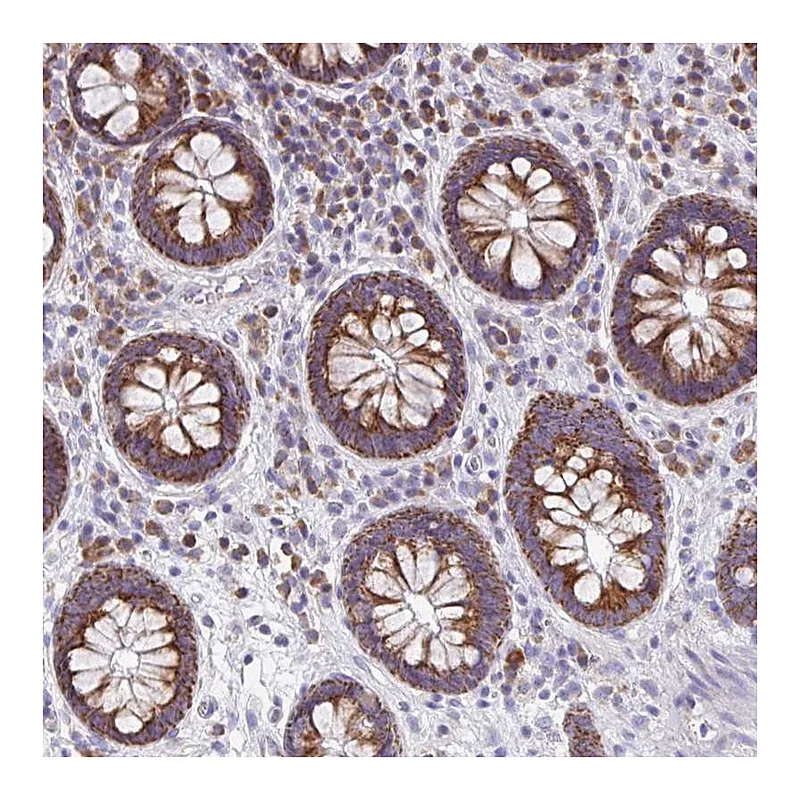 Atlas Antibodies Anti-MRPL11 Antibody