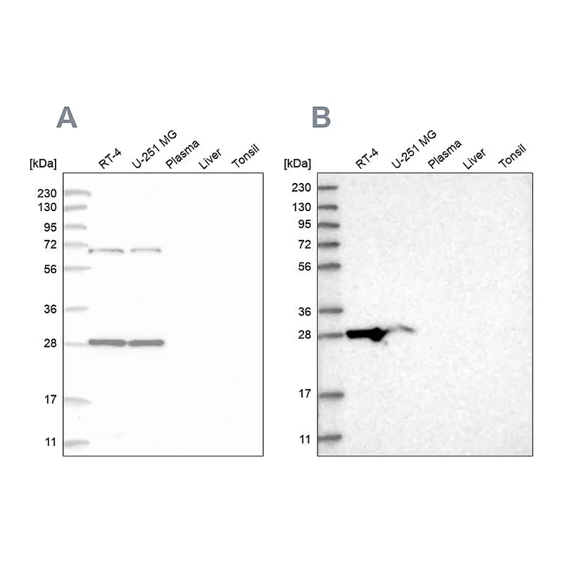 Atlas Antibodies Anti-MRPL10 Antibody
