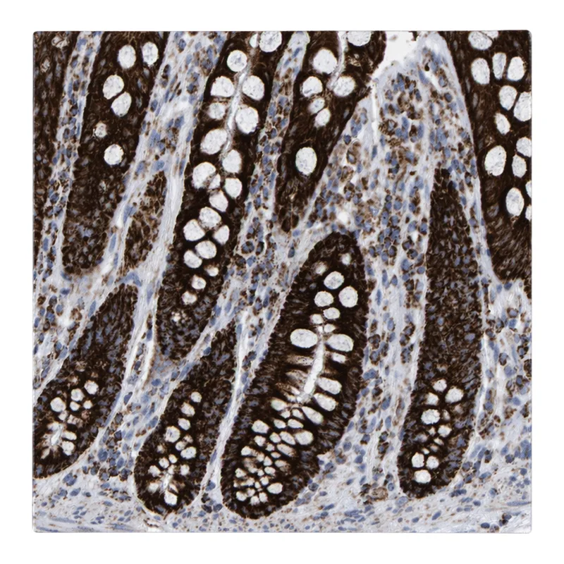 Atlas Antibodies Anti-MRPL12 Antibody
