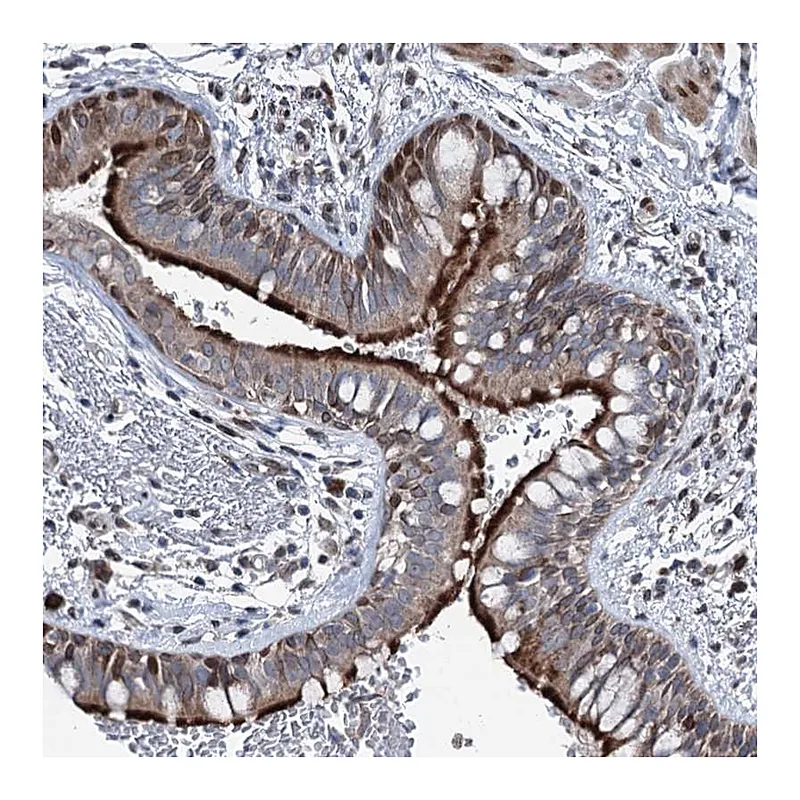 Atlas Antibodies Anti-MRPL14 Antibody