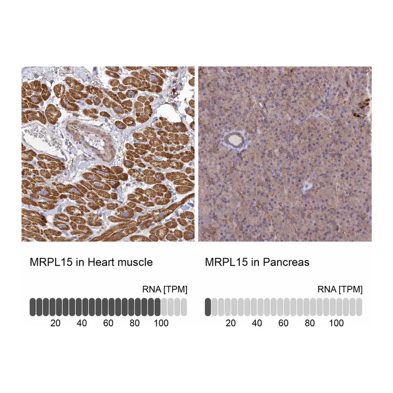Atlas Antibodies Anti-MRPL15 Antibody