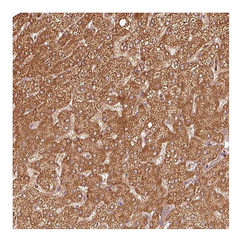 Atlas Antibodies Anti-MRPL16 Antibody