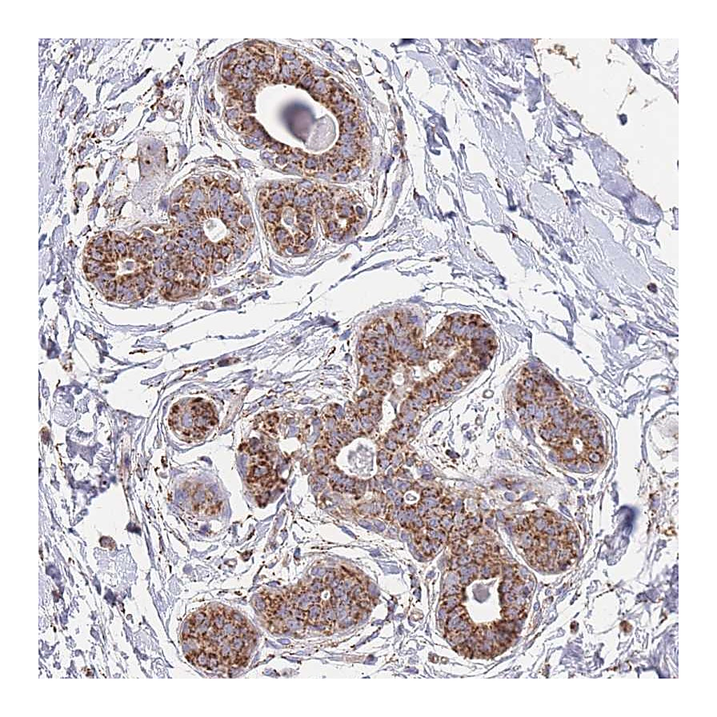 Atlas Antibodies Anti-MRPL17 Antibody