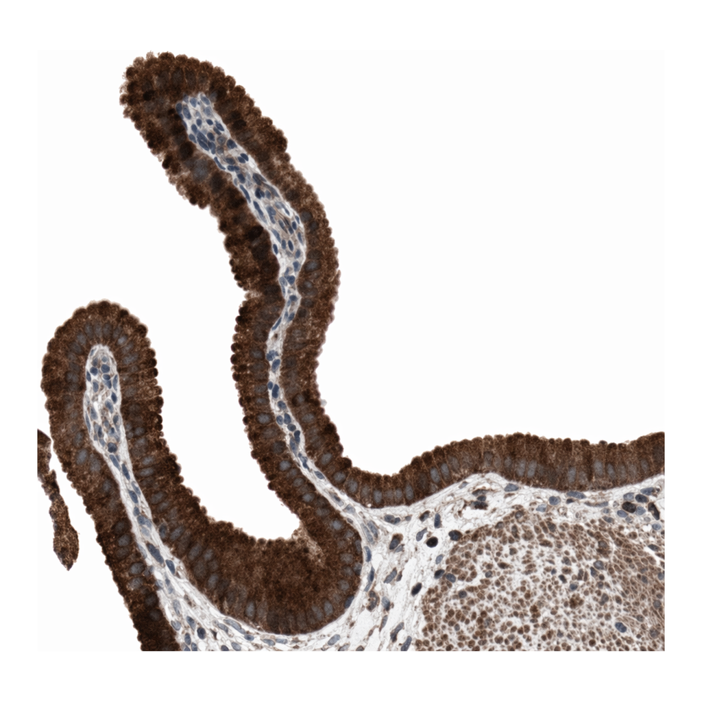 Atlas Antibodies Anti-MRPL2 Antibody
