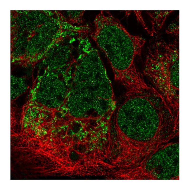 Atlas Antibodies Anti-MRPL2 Antibody