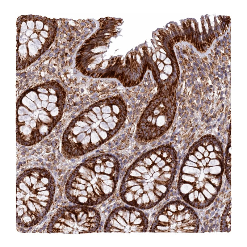 Atlas Antibodies Anti-MRPL20 Antibody