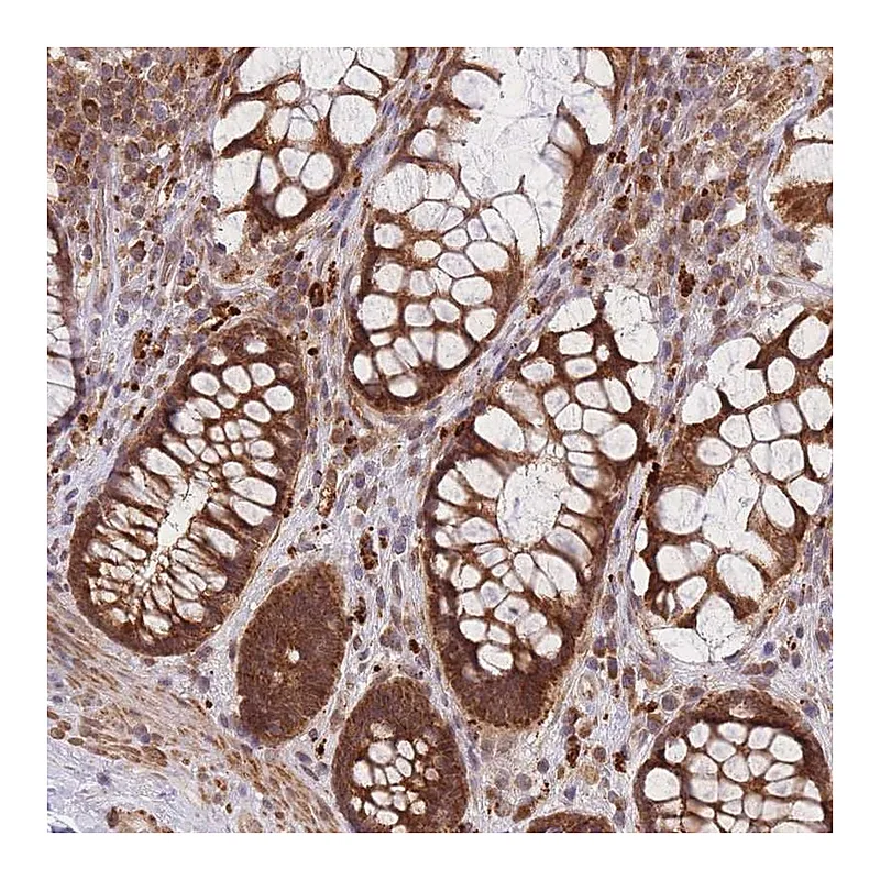 Atlas Antibodies Anti-MRPL23 Antibody